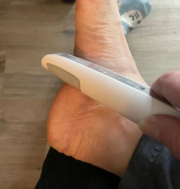 SilkStep Pro Foot Care Device | Electric Callus Remover, USB Rechargeable 7